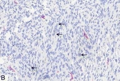 Western Blot: Podoplanin Antibody (LF3/B7/D5B27) - Azide and BSA Free [NB110-96423] - Non-neoplastic histopathological findings in the abdominal cavity. A: High-power view of anti-podoplanin immunohistochemistry showing single MWCNT A (high dose) nanotubes in the tissue (arrows). B: High-power view of anti-podoplanin immunohistochemistry showing single asbestos fibers in the tissue (arrows). C: H & E, high-power view of granuloma induced by MWCNT A (low dose) nanotubes including single nanotube (arrow, 25×). D: H & E, high-power view of granuloma induced by asbestos including single fiber (arrow, 40×). Image collected & cropped by CiteAb from the following publication (//particleandfibretoxicology.biomedcentral.com/articles/10.1186/s12989-014-0059-z), licensed under a CC-BY license. Not internally tested by Novus Biologicals.