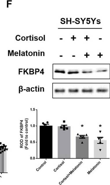 Melatonin downregulates FKBP4, but is not related to phosphorylation of GR.A–C, F SH-SY5Y cells were treated with melatonin (1 μM) for 30 min and then with cortisol (1 μM) for 24 h. A The expression of p-GR and GR were detected by western blot. Loading control is  beta -actin. n = 5. B The expression of GR protein in subcellular fraction samples was detected by western blotting. Lamin A/C and  alpha -tubulin were used as a nuclear and cytosolic loading control, respectively. n = 5. C The cells were immunostained with GR (green) and DAPI (blue). Scale bars, 10 μm (magnification, ×1000). n = 5. D, G Mice were injected with melatonin (10 mg/kg) and then with corticosterone (10 mg/kg) for 7 days. D Slide samples for immunohistochemistry were immunostained with GR (green) and DAPI (blue). Scale bars, 140 μm (magnification, ×100). n = 5. E SH-SY5Y cells were treated with melatonin for 30 min and then with cortisol for 12 h. The mRNA expression of regulatory proteins related to cytosolic GR complex, dynein complex, and NPC were analyzed by real time PCR. n = 5. F, G FKBP4 was detected by western blot. Loading control is  beta -actin. n = 5. All blots and immunofluorescence images are representative. The representative images were acquired by SRRF imaging system. All data are presented as a mean +/- S.E.M. *p < 0.05 versus control, #p < 0.05 versus cortisol or corticosterone. Image collected and cropped by CiteAb from the following open publication (//pubmed.ncbi.nlm.nih.gov/36810730), licensed under a CC-BY license. Not internally tested by Novus Biologicals.