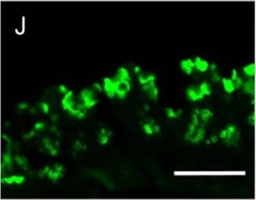 Immunocytochemistry/ Immunofluorescence: MUC2 Antibody (996/1) - BSA Free [NB120-11197] - MS-induced intestinal epithelium injury was CRHR1 dependent.Photomicrographs of hematoxylin & eosin (H&E) stained (A–E) & immunofluorescence of Mucin 2 (Muc2; mucous-forming protein) (F–J) in proximal colon in all experimental groups. Histological scores (K) were highest in MS, demonstrated injury in MS compared to control. Treatment with Antalarmin & Astressin prevented this MS-induced colonic injury, but not by Astressin-2 beta . Crypt length in μm (L) (red lines in photomicrographs A–E) & the number of Muc2+ goblet cells per crypt (M) were reduced by MS compared to control, & restored to control levels following Antalarmin & Astressin treatment. Astressin-2 beta  did not prevent these MS-induced effects. Myeloperoxidase (MPO; μmol/mg protein) expression was increased in MS group & was reduced to a level similar to control by treatment with Antalarmin but not by treatment with Astressin or Astressin-2 beta  (N). Western blot analysis of NF-kappa B showed an increase in the phosphorylated expression of NF-kappa B in MS, which was prevented by Antalarmin administration, but not by Astressin or Astressin-2 beta  (O,P). Trans-cellular flux of HRP (ng/ml.cm2.min; Q) measured by Ussing Chamber was increased in MS & MS + Astressin-2 beta  groups, compared to control, but not in MS + Antalarmin & MS + Astressin groups (P). Results are means, ±SD. p < 0.05 was considered significant. Image collected & cropped by CiteAb from the following publication (//www.nature.com/articles/srep46616), licensed under a CC-BY license. Not internally tested by Novus Biologicals.