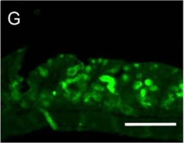 Immunocytochemistry/ Immunofluorescence: MUC2 Antibody (996/1) - BSA Free [NB120-11197] - MS-induced intestinal epithelium injury was CRHR1 dependent.Photomicrographs of hematoxylin & eosin (H&E) stained (A–E) & immunofluorescence of Mucin 2 (Muc2; mucous-forming protein) (F–J) in proximal colon in all experimental groups. Histological scores (K) were highest in MS, demonstrated injury in MS compared to control. Treatment with Antalarmin & Astressin prevented this MS-induced colonic injury, but not by Astressin-2 beta . Crypt length in μm (L) (red lines in photomicrographs A–E) & the number of Muc2+ goblet cells per crypt (M) were reduced by MS compared to control, & restored to control levels following Antalarmin & Astressin treatment. Astressin-2 beta  did not prevent these MS-induced effects. Myeloperoxidase (MPO; μmol/mg protein) expression was increased in MS group & was reduced to a level similar to control by treatment with Antalarmin but not by treatment with Astressin or Astressin-2 beta  (N). Western blot analysis of NF-kappa B showed an increase in the phosphorylated expression of NF-kappa B in MS, which was prevented by Antalarmin administration, but not by Astressin or Astressin-2 beta  (O,P). Trans-cellular flux of HRP (ng/ml.cm2.min; Q) measured by Ussing Chamber was increased in MS & MS + Astressin-2 beta  groups, compared to control, but not in MS + Antalarmin & MS + Astressin groups (P). Results are means, ±SD. p < 0.05 was considered significant. Image collected & cropped by CiteAb from the following publication (//www.nature.com/articles/srep46616), licensed under a CC-BY license. Not internally tested by Novus Biologicals.