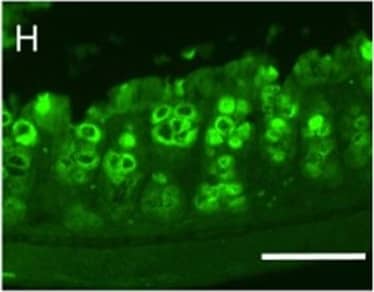 Immunocytochemistry/ Immunofluorescence: MUC2 Antibody (996/1) - BSA Free [NB120-11197] - MS-induced intestinal epithelium injury was CRHR1 dependent.Photomicrographs of hematoxylin & eosin (H&E) stained (A–E) & immunofluorescence of Mucin 2 (Muc2; mucous-forming protein) (F–J) in proximal colon in all experimental groups. Histological scores (K) were highest in MS, demonstrated injury in MS compared to control. Treatment with Antalarmin & Astressin prevented this MS-induced colonic injury, but not by Astressin-2 beta . Crypt length in μm (L) (red lines in photomicrographs A–E) & the number of Muc2+ goblet cells per crypt (M) were reduced by MS compared to control, & restored to control levels following Antalarmin & Astressin treatment. Astressin-2 beta  did not prevent these MS-induced effects. Myeloperoxidase (MPO; μmol/mg protein) expression was increased in MS group & was reduced to a level similar to control by treatment with Antalarmin but not by treatment with Astressin or Astressin-2 beta  (N). Western blot analysis of NF-kappa B showed an increase in the phosphorylated expression of NF-kappa B in MS, which was prevented by Antalarmin administration, but not by Astressin or Astressin-2 beta  (O,P). Trans-cellular flux of HRP (ng/ml.cm2.min; Q) measured by Ussing Chamber was increased in MS & MS + Astressin-2 beta  groups, compared to control, but not in MS + Antalarmin & MS + Astressin groups (P). Results are means, ±SD. p < 0.05 was considered significant. Image collected & cropped by CiteAb from the following publication (//www.nature.com/articles/srep46616), licensed under a CC-BY license. Not internally tested by Novus Biologicals.