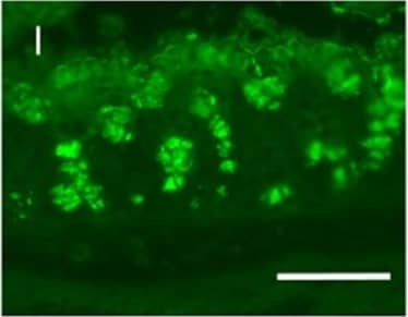 Immunocytochemistry/ Immunofluorescence: MUC2 Antibody (996/1) - BSA Free [NB120-11197] - MS-induced intestinal epithelium injury was CRHR1 dependent.Photomicrographs of hematoxylin & eosin (H&E) stained (A–E) & immunofluorescence of Mucin 2 (Muc2; mucous-forming protein) (F–J) in proximal colon in all experimental groups. Histological scores (K) were highest in MS, demonstrated injury in MS compared to control. Treatment with Antalarmin & Astressin prevented this MS-induced colonic injury, but not by Astressin-2 beta . Crypt length in μm (L) (red lines in photomicrographs A–E) & the number of Muc2+ goblet cells per crypt (M) were reduced by MS compared to control, & restored to control levels following Antalarmin & Astressin treatment. Astressin-2 beta  did not prevent these MS-induced effects. Myeloperoxidase (MPO; μmol/mg protein) expression was increased in MS group & was reduced to a level similar to control by treatment with Antalarmin but not by treatment with Astressin or Astressin-2 beta  (N). Western blot analysis of NF-kappa B showed an increase in the phosphorylated expression of NF-kappa B in MS, which was prevented by Antalarmin administration, but not by Astressin or Astressin-2 beta  (O,P). Trans-cellular flux of HRP (ng/ml.cm2.min; Q) measured by Ussing Chamber was increased in MS & MS + Astressin-2 beta  groups, compared to control, but not in MS + Antalarmin & MS + Astressin groups (P). Results are means, ±SD. p < 0.05 was considered significant. Image collected & cropped by CiteAb from the following publication (//www.nature.com/articles/srep46616), licensed under a CC-BY license. Not internally tested by Novus Biologicals.