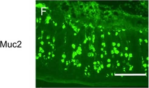 Immunocytochemistry/ Immunofluorescence: MUC2 Antibody (996/1) - BSA Free [NB120-11197] - MS-induced intestinal epithelium injury was CRHR1 dependent.Photomicrographs of hematoxylin & eosin (H&E) stained (A–E) & immunofluorescence of Mucin 2 (Muc2; mucous-forming protein) (F–J) in proximal colon in all experimental groups. Histological scores (K) were highest in MS, demonstrated injury in MS compared to control. Treatment with Antalarmin & Astressin prevented this MS-induced colonic injury, but not by Astressin-2 beta . Crypt length in μm (L) (red lines in photomicrographs A–E) & the number of Muc2+ goblet cells per crypt (M) were reduced by MS compared to control, & restored to control levels following Antalarmin & Astressin treatment. Astressin-2 beta  did not prevent these MS-induced effects. Myeloperoxidase (MPO; μmol/mg protein) expression was increased in MS group & was reduced to a level similar to control by treatment with Antalarmin but not by treatment with Astressin or Astressin-2 beta  (N). Western blot analysis of NF-kappa B showed an increase in the phosphorylated expression of NF-kappa B in MS, which was prevented by Antalarmin administration, but not by Astressin or Astressin-2 beta  (O,P). Trans-cellular flux of HRP (ng/ml.cm2.min; Q) measured by Ussing Chamber was increased in MS & MS + Astressin-2 beta  groups, compared to control, but not in MS + Antalarmin & MS + Astressin groups (P). Results are means, ±SD. p < 0.05 was considered significant. Image collected & cropped by CiteAb from the following publication (//www.nature.com/articles/srep46616), licensed under a CC-BY license. Not internally tested by Novus Biologicals.