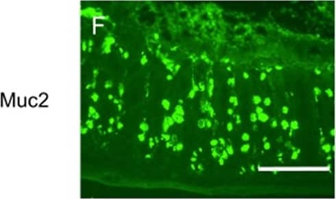 MS-induced intestinal epithelium injury was CRHR1 dependent.Photomicrographs of hematoxylin and eosin (H&E) stained (A–E) and immunofluorescence of Mucin 2 (Muc2; mucous-forming protein) (F–J) in proximal colon in all experimental groups. Histological scores (K) were highest in MS, demonstrated injury in MS compared to control. Treatment with Antalarmin and Astressin prevented this MS-induced colonic injury, but not by Astressin-2 beta . Crypt length in μm (L) (red lines in photomicrographs A–E) and the number of Muc2+ goblet cells per crypt (M) were reduced by MS compared to control, and restored to control levels following Antalarmin and Astressin treatment. Astressin-2 beta  did not prevent these MS-induced effects. Myeloperoxidase (MPO; μmol/mg protein) expression was increased in MS group and was reduced to a level similar to control by treatment with Antalarmin but not by treatment with Astressin or Astressin-2 beta  (N). Western blot analysis of NF-kappa B showed an increase in the phosphorylated expression of NF-kappa B in MS, which was prevented by Antalarmin administration, but not by Astressin or Astressin-2 beta  (O,P). Trans-cellular flux of HRP (ng/ml.cm2.min; Q) measured by Ussing Chamber was increased in MS and MS + Astressin-2 beta  groups, compared to control, but not in MS + Antalarmin and MS + Astressin groups (P). Results are means, +/-SD. p < 0.05 was considered significant. Image collected and cropped by CiteAb from the following open publication (//pubmed.ncbi.nlm.nih.gov/28492284), licensed under a CC-BY license. Not internally tested by Novus Biologicals.