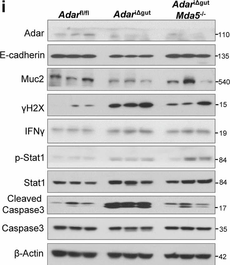 MDA5-mediated dsRNA sensing is required for intestinal Adar deficiency-induced bowel inflammation and organoid death.a Representative images of Adar (green) and J2 (red) staining in organoids isolated from the ileum of Villin-CreERT2 Adarfl/fl mice and treated with or without 4-OHT (200 nM) for 3 days.Scale bars: 100 μm. b Representative images of J2 staining (green) on ileal sections of Adarfl/fl and Adari delta gut mice (3 dpi). Scale bars: 100 μm. c Survival curves of Adarfl/fl, Adari delta gut, and Adari delta gutMda5−/−mice after tamoxifen induction (n = 5 for Adarfl/fl, n = 8 for Adari delta gut, n = 6 for Adari delta gutMda5−/−). d, hAdarfl/fl, Adari delta gut and Adari delta gutMda5−/− mice after tamoxifen induction at 3-dpi. d Small intestine and colon length (n = 5 for Adarfl/fl, n = 7 for Adari delta gut, n = 6 for Adari delta gutMda5−/−). e H&E staining of intestinal sections. Scale bars: 100 μm. Shown on the right are quantifications of histopathological scores, and lengths of ileal crypts and villi (n = 5). f Representative images of TUNEL staining (green) on the ileal sections. Scale bars: 100 μm. g Immunofluorescence of E-cadherin (red) staining. Scale bars: 100 μm. h Immunofluorescence of Lysozyme (green) and Muc2 (red) staining. Scale bars: 100 μm. i Western blot analysis of ileal samples (n = 3). j Representative images of the growth process of organoids isolated from the ileum of Adari delta gut and Adari delta gutMda5−/− mice treated with or without 4-OHT. Scale bars: 100 μm. Data are presented as the mean +/- SEM. The statistical significance was analyzed using Log-rank (Mantel-Cox) test (Fig. 5c). The remaining statistical differences were determined using one-way ANOVA with multiple comparisons. Source data are provided in the Source data file. Image collected and cropped by CiteAb from the following open publication (//www.nature.com/articles/s41467-025-63554-4), licensed under a CC-BY license. Not internally tested by Novus Biologicals.