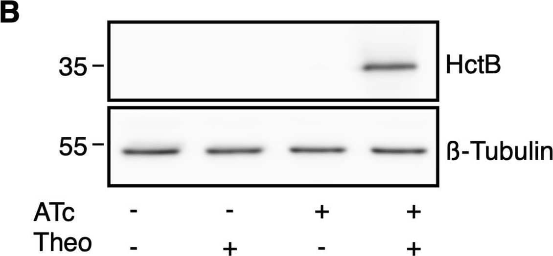 Characterization of p2TK2-SW2-Tet-J-E-hctB-flag.A) Schematic of the Te-riboJ-E-hctB-flag construct. HctB expression is controlled by an aTc inducible promoter, riboJ insulator and the riboE riboswitch. B) Anti-flag western blot of Cos-7 cells infected with L2-Tet-J-E-hctB-flag comparing expression of theophylline treated and untreated cultures. Cells were induced with 0.5 mM theophylline, 30ng/ml aTc, both aTc and theophylline or vehicle only at 16 hpi and proteins were harvested at 30 hpi. HctB-flag expression was only detected in the samples induced with both aTc and theophylline. C) Confocal micrographs of Cos-7 cells infected with L2-Tet-riboJ-E-hctB-flag, induced with 0.5 mM theophylline, 30ng/ml aTc, both aTc and theophylline or vehicle only at 16 hpi and fixed and stained with DAPI (blue) for confocal microscopy at 30 hpi. The flag tag was stained with a primary antibody to the flag and an alexa 488 anti-mouse secondary antibody (green). Size bar = 10 μm. D) Production of infectious progeny was determined using a reinfection assay. Cos-7 cells were infected with L2-Tet-J-E-hctB-flag and the production of infectious progeny was determined at 48 hpi after induction with 0.5 mM theophylline, 30ng/ml aTc, both aTc and theophylline or vehicle only at 16 hpi. Asterisks denote p-values < 0.05. Error bars = SEM. Image collected and cropped by CiteAb from the following open publication (//pubmed.ncbi.nlm.nih.gov/35085261), licensed under a CC-BY license. Not internally tested by Novus Biologicals.