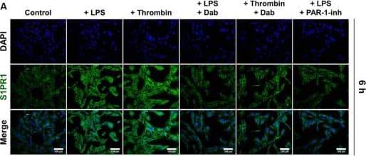 Immunofluorescence of proteins related to S1P signaling in astrocytes. Astrocytes were treated with LPS or thrombin, with or without Dab or PAR-1-inh (LPS only) for 6 h. Cells were stained for (A) S1P receptor 1 (S1PR1), (B) sphingosine kinase (SphK1), and (C) SphK2 in green and nuclei (DAPI) in blue. Scale bar = 100 μm. Green fluorescence was quantified by measuring the relative mean IOD. The data are presented as the mean +/- SD (n = 3), *p < 0.05. Image collected and cropped by CiteAb from the following open publication (//pubmed.ncbi.nlm.nih.gov/32694981), licensed under a CC-BY license. Not internally tested by Novus Biologicals.