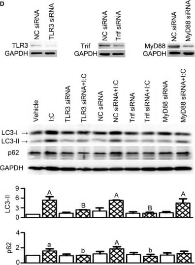 A TLR3 agonist polyinosinic‐polycytidylic acid (poly(I:C)) induced autophagy in cultured cardiomyocytes through a TRIF‐dependent pathway. (A) Poly(I:C) increased autophagy markers in cultured H9c2 rat ventricular cells. (B) Poly(I:C) stimulated autophagosome formation but did not affect autophagic flux. Primary cultured neonatal rat ventricular myocytes (NRVMs) were transfected with a tandem mRFP‐GFP‐LC3 adenovirus for 24 hrs, followed by treatment with poly(I:C) (100 μg/ml, 4 hrs). Autophagosomes & autolysosomes were, respectively, visualized as yellow‐ & red‐only punctas under a confocal microscope. (C) An autophagic flux inhibitor chloroquine (CQ) induced accumulations of LC3‐II & p62/SQSTM1 proteins in H9c2 myocytes receiving poly(I:C) (100 μg/ml, 4 hrs). CQ was applied at 10 μM, immediately prior to poly(I:C). (D) Effects of indicated siRNA on poly(I:C)‐induced changes in autophagy markers in NRVMs. All the siRNAs were transfected at 50 nM for 48 hrs, & poly(I:C) was added at 100 μg/ml for 4 hrs before cell harvest. Negative control (NC) siRNA served as control. RNAiMAX transfection reagent was used in all the siRNA experiments. The upper panel shows the knockdown effects of siRNAs, & the lower panel shows representative Western blot images (presented from four independent experiments) & densitometry quantitative data (normalized into ‘fold of vehicle group’). All quantitative data are expressed as means ± S.D. aP < 0.05, AP < 0.01 versus vehicle; bP < 0.05, BP < 0.01 versus poly(I:C). Image collected & cropped by CiteAb from the following publication (//pubmed.ncbi.nlm.nih.gov/28945004), licensed under a CC-BY license. Not internally tested by Novus Biologicals.