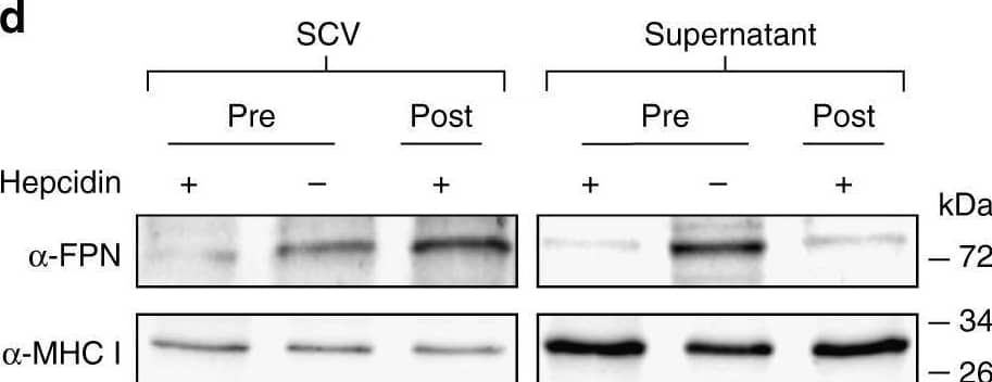 The presence of FPN in the SCV of Raw264.7 cells. a Raw264.7 cells pretreated with FeSO4 (0.1 mM) and/or hepcidin (1 μg/ml) for 3 h were infected with Salmonella (MOI, 100) and examined by confocal microscopy. Enlarged images of merge panels are shown in Supplementary Fig. 17. b The cells pretreated with PBS or hepcidin were infected with magnetized Salmonella (MOI, 100) for 2 h, and then SCV were isolated and Salmonella were analyzed by confocal microscopy. Staining for FPN is shown in green, and Salmonella in red. The isolated SCV were visualized by differential interphase contrast (DIC) imaging (scale bar 10 μm). Images are representatives of over 500 isolated SCVs per group from at least three independent experiments. c Raw264.7 cells pretreated with hepcidin were infected with magnetized Salmonella. FPN, Rab5, and annexin V in the SCV and the non-SCV fraction (supernatant) were examined by western blotting using specific antibodies. d Alternatively, Raw264.7 cells infected with Salmonella were treated with hepcidin for 2 h post infection and analyzed as in c Image collected and cropped by CiteAb from the following open publication (//pubmed.ncbi.nlm.nih.gov/29844422), licensed under a CC-BY license. Not internally tested by Novus Biologicals.