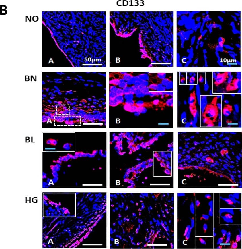Immunostaining for CD133 in normal ovarian and tumor tissue sections: [A] Mouse monoclonal anti-CD133 antibody was localized in both OSE (A, B) and ovarian cortex (C, D) by immunohistochemistry. Region between dotted boxes in A, C is magnified in B, D respectively. Polar staining of CD133 is obvious in OSE layer especially in NO, BL and HG ovaries. BL ovaries exhibit multi-layered OSE. Cortex comprised of CD133+ cells arranged in clusters with elongated/spindle shaped morphology in NO and BN ovaries. BL ovarian cortex harbours single spherical cell clusters distributed throughout. HG comprised more of large CD133+ cells in OSE and few clusters in the cortex per field focussed. Insets include magnified images of cells from different fields. Scale bar = 100 μm (A, C) and 25 μm (B, D) respectively. [B] Immunofluorescence staining of CD133 in OSE layer (A, B) as well as cortex (C) reveals specific CD133+ cells with relatively higher cell numbers in BL and HG. Area within dotted lines in BN OSE (A) are magnified in (B) while elliptical/spindle shaped CD133+ cells in cortex from various fields were represented in the composite image in (C) of BN and HG. Large CD133+ cells in cortex were also observed. White scale bar = 50 μm; blue scale bar = 10 μm. Secondary antibody employed was conjugated with Alexa fluor 568 and tissue sections were counterstained with nucleus specific dye DAPI Image collected and cropped by CiteAb from the following open publication (//pubmed.ncbi.nlm.nih.gov/30121075), licensed under a CC-BY license. Not internally tested by Novus Biologicals.