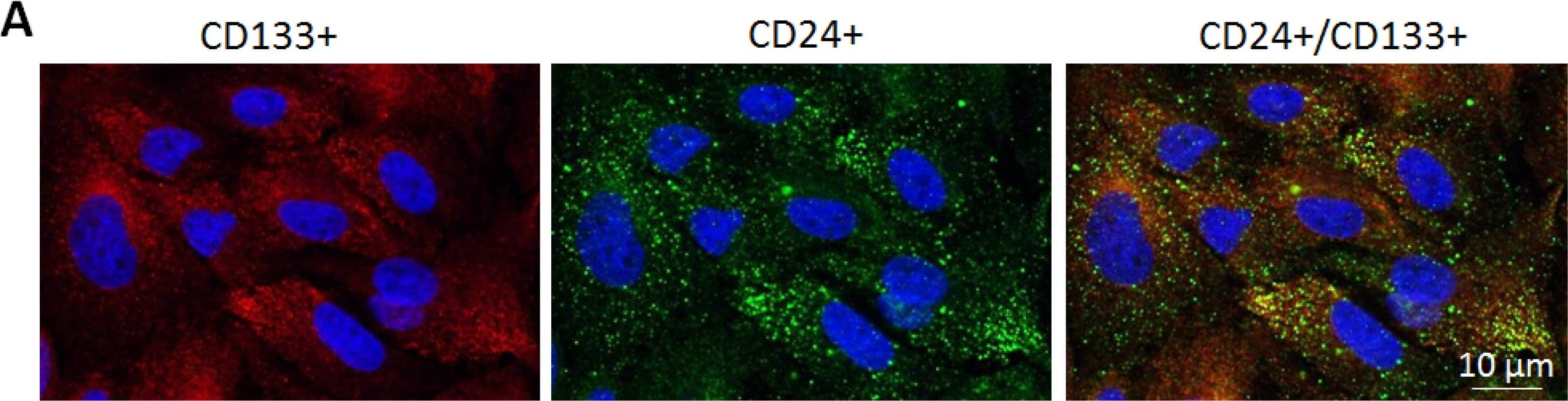 Immunocytochemistry/ Immunofluorescence: CD133 Antibody [DyLight 488] [NB120-16518G] - Characterization of Scattered tubular-like cells (STCs) isolated from pig kidneys. (A) Representative immunofluorescence staining (original magnification 40X) for the STC surface markers CD133 (red) & CD24 (green) in isolated swine STCs. (B) Flow cytometry analysis of isolated STCs showing that 97% of cells expressed CD133, 95% CD24, & 98% were double-positive for CD133 & CD24 (n = 3 each). Image collected & cropped by CiteAb from the following publication (//pubmed.ncbi.nlm.nih.gov/31614781), licensed under a CC-BY license. Not internally tested by Novus Biologicals.