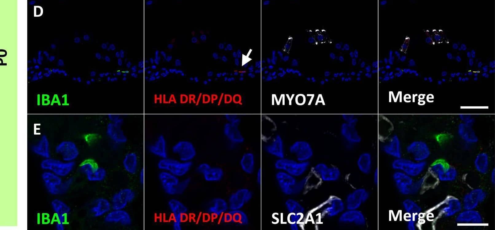 Expression of human leukocyte antigen (HLA) DR/DP/DQ in the developing cochlea. (A, B) Expression of HLA DR/DP/DQ in the E109 and E120 cochlea. No HLA DR/DP/DQ expression is observed in these stages. (C–E) Expression of HLA DR/DP/DQ in the P0 cochlea. At this stage, some macrophages expressed HLA DR/DP/DQ. HLA DR/DP/DQ expression is observed in macrophages in the organ of Corti [Arrow in (D)]. No HLA DR/DP/DQ expression is detected in the perivascular macrophages (PVMs) in the stria vascularis at this stage (E). (F) HLA DR/DP/DQ expression in the postnatal stria vascularis. HLA DR/DP/DQ expression is detected in the postnatal PVMs. Scale Bar: 100 μm in (A–C) 50 μm in (D, E) 20 μm in (F) The nuclei are counterstained with Hoechst (blue). Image collected and cropped by CiteAb from the following open publication (//pubmed.ncbi.nlm.nih.gov/37675123), licensed under a CC-BY license. Not internally tested by Novus Biologicals.