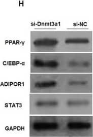 Western Blot: PPAR gamma/NR1C3 Antibody [NB120-19481] - Dnmt3a1 decreases lipid droplet accumulation in the early stage of adipocyte differentiation. (A) Representative images of oil red O staining (red) & DAPI staining (blue) after transfection with pSDS-Dnmt3a1 & pSDS-NC for 48 h are showed; scale bar: 25 μm. (B) Lipid droplet content by oil red O staining & extraction method of cells transfected with pSDS-Dnmt3a1 & pSDS-NC for 48 h. Values represent mean ± SEM from three independent experiments. ∗∗P < 0.01. (C) Representative images of oil red O staining (red) & DAPI staining (blue) after transfection with si-Dnmt3a1 & si-NC for 48 h are showed; scale bar: 25 μm. (D) Lipid droplet content by oil red O staining & the extraction method of cells transfected with si-Dnmt3a1 & si-NC for 48 h. Values represent mean ± SEM from three independent experiments. ∗P < 0.05. (E) Relative mRNA level of some general genes implicated in adipogenesis or energy homeostasis induced by pSDS-Dnmt3a1 & pSDS-NC into cells. Values represent mean ± SEM from four separate experiments. ∗P < 0.05, ∗∗P < 0.01, & ∗∗∗P < 0.001. (F) Protein expression of some general adipose genes induced by pSDS-Dnmt3a1 & pSDS-NC into cells. (G) Relative mRNA level of some general genes involved in adipogenesis or energy homeostasis after transfection with si-Dnmt3a1 & si-NC into cells for 48 h. Values represent mean ± SEM from four separate experiments. ∗P < 0.05, ∗∗P < 0.01, & ∗∗∗P < 0.001. (H) Protein expression of some general genes involved in adipogenesis at 48 h after transfection by si-Dnmt3a1 & si-NC into cells. The band intensity of Western blotting was obtained by averaging the data from three independent experiments. Image collected & cropped by CiteAb from the following publication (//pubmed.ncbi.nlm.nih.gov/30333755), licensed under a CC-BY license. Not internally tested by Novus Biologicals.