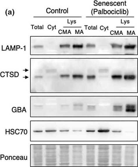HSPA8 activates EMT by abrogating CAV1‐mediated inhibition of the  beta ‐catenin/Wnt pathway in BRAF V600E CRC cells. A) The interactions between CAV1 and several proteins, including LAMP2A,  beta ‐catenin, and LC3, in HEK293T cells were determined by co‐IP assays. B) The interaction between CAV1 and  beta ‐catenin in RKO cells stably expressing shScramble or shHSPA8 was determined by co‐IP assays. C) Immunoblotting analysis of  beta ‐catenin protein expression in the cytoplasm or nucleus in RKO cells stably expressing shScramble or shHSPA8. GAPDH is used as cytoplasmic marker and Histone 3 (H3) is a nuclear marker. D,E) Immunofluorescence assays display the subcellular localization of  beta ‐catenin in RKO cells transfected with shScramble, shHSPA8, shScramble+siCAV1, or shHSPA8+siCAV1. Scale bar: 10 um. F) Immunoblotting analysis of the expression of HSPA8, CAV1, and ZO‐1 in RKO cells transfected with shScramble, shHSPA8, shScramble+siCAV1, or shHSPA8+siCAV1. G,H) Transwell assays showing the cell migration and invasion of RKO cells transfected with shScramble, shHSPA8, or shHSPA8+siCAV1. Scale bar: 100 um. I,J) Wound healing assay showing the migration of RKO cells transfected with shScramble, shHSPA8, or shHSPA8+siCAV1 after 24 h. Scale bar: 200 um. K) Real‐time qPCR analysis was performed to examine the mRNA expression levels (mean +/- SEM) of MMPs in RKO cells stably expressing shScramble or shHSPA8. ***P  0.05 in N/L versus vehicle or that have a negative log2 fold change N/L versus vehicle. (e) Top lysosomal resident proteins found at higher or lower levels in CMA and MA lysosomes. (f) Fold change (over control) in protein levels of TOR protein components found in both CMA and MA lysosomes. Image collected and cropped by CiteAb from the following open publication (//pubmed.ncbi.nlm.nih.gov/36087066), licensed under a CC-BY license. Not internally tested by Novus Biologicals.