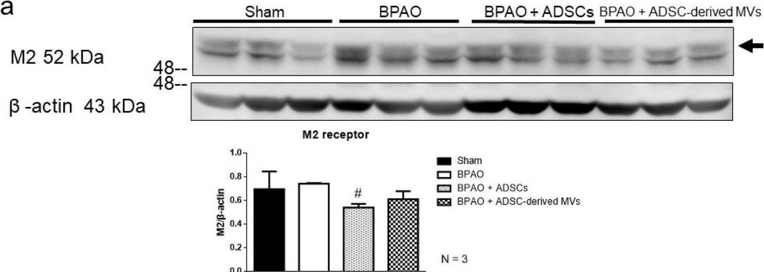 Purinergic and muscarinic signaling associated molecules changes on western blot study in separated group. Figure 7 showed the expression of muscarinic cholinergic (M2 and M3) and purinergic receptor proteins (P2X2 and P2X3) by Western blot. In the top panel, (a) showed the expression of M2 receptor is significantly decreased in BPAO + ADSCs group compared to BAPO group (# p  0.05). In the middle panel, (b) showed that the expression of M3 receptor was significantly increased in BPAO group compared to sham group (* p < 0.05). The expression of M3 receptor is significantly decreased in BPAO + ADSC-derived MVs group compared to BAPO group (# p < 0.05). (c) showed the expression of P2X2 receptors was significantly increased in BPAO group compared to sham group (* p < 0.05). The expression of P2X2 receptor is significantly decreased in BPAO + ADSC-derived MVs and BAPO + MVs group compared to BAPO group (#p < 0.05). In the bottom panel, (d) showed the expression of P2X3 receptor is of no significant differences between groups. Image collected and cropped by CiteAb from the following open publication (//pubmed.ncbi.nlm.nih.gov/34210091), licensed under a CC-BY license. Not internally tested by Novus Biologicals.