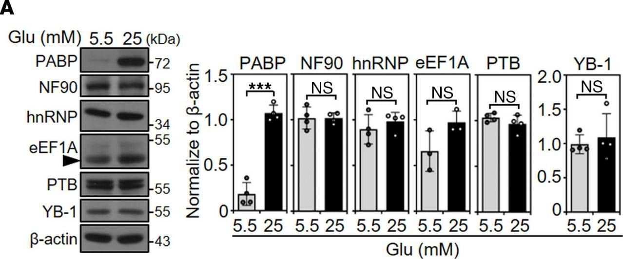 PI3K/AKT signaling contributes to HG-induced PABP expression, which promotes DENV infection.(A) Western blot showed the expression of PABP, NF90, hnRNP, eEF1A, PTB, YB-1, and  beta -actin in 5.5 or 25 mM glucose (Glu) medium–treated BHK-21 cells for 48 hours. (B) Furthermore, the time course expression of PABP protein also is shown. (C) Western blot showed PABP protein expression in BHK-21 cells that were pretreated with or without PI3K inhibitor (LY294002), the mTOR inhibitor rapamycin (Rapa), or AKT inhibitor (AKTi) for 1 hour followed by 5.5 or 25 mM Glu-containing–medium treatment for 48 hours. (D) Real-time qPCR assays showed the expression of PABP mRNA in 5.5 or 25 mM Glu-treated BHK-21 cells that were pretreated with or without LY294002 and an AKTi for 1 hour and subsequently maintained in medium containing 5.5 or 25 mM Glu for 48 hours. (E) Western blot showed PABP protein expression in BHK-21 cells pretreated with PABP siRNA (siPABP) for 48 hours, followed by incubation with medium containing 25 mM Glu. Cells without control siRNA pretreatment were used as negative control. (F) Plaque assays were conducted to determine the viral titer of BHK-21 cells that were pretreated with PABP siRNA for 48 hours and then infected with DENV 2 (MOI, 1) for an additional 48 hours in 5.5 or 25 mM Glu-containing medium. DMSO was used as a control. The mean +/- SD of quantitative data from at least 3 independent experiments are reported. **P < 0.01, ***P < 0.001. RQ, relative quantification. Image collected and cropped by CiteAb from the following open publication (//pubmed.ncbi.nlm.nih.gov/36125898), licensed under a CC-BY license. Not internally tested by Novus Biologicals.