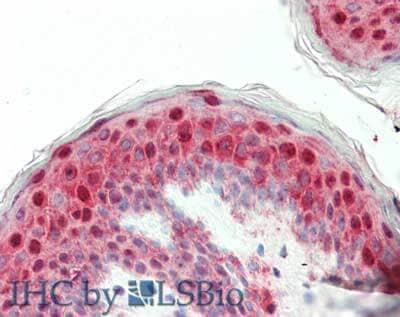 Immunohistochemistry of Laminin beta 1 Antibody.  Tissue: human placenta.  Fixation: formalin fixed paraffin embedded.  Antigen retrieval: not required. Primary antibody: Anti-Laminin at 5 ug/mL for 1 h at RT. Secondary antibody: Peroxidase rabbit secondary antibody at 1:10,000 for 45 min at RT. Staining: Laminin as precipitated red signal with hematoxylin purple nuclear counterstain.