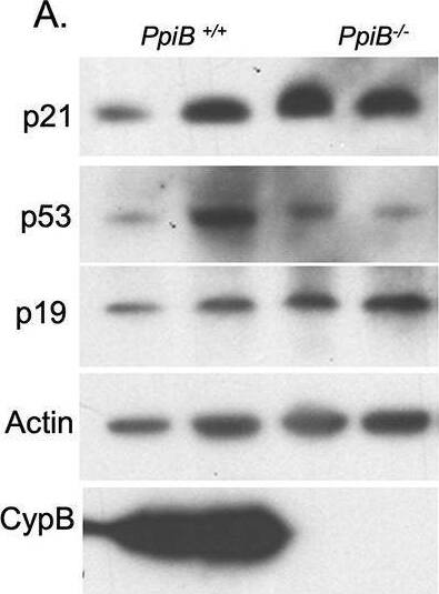 Senescence marker p21 protein is elevated in CypB‐deficient cells and tissues. (A) Western blot showing levels of p21, p53, p19, and CypB in wild‐type and CypB‐null primary multipotent stromal cells, with quantitative data of p21 from two independent experiments on two individual lines generated from each mouse strain. *p < 0.01, unpaired two‐tailed t test. (B) Western blot showing levels of p21 and CypB in wild‐type and CypB null primary osteoblasts with quantitative data of p21 from five PpiB+/+ lines and three PpiB−/− lines. *p < 0.05, unpaired two‐tailed t test. (C) Western blot showing levels of p21 and CypB in IAT collected from CypB wild‐type (n = 3) and null mice (n = 4) and the quantitative data of p21 abundance in IAT. *p < 0.05, unpaired two‐tailed t test. Image collected and cropped by CiteAb from the following open publication (//pubmed.ncbi.nlm.nih.gov/36248275), licensed under a CC-BY license. Not internally tested by Novus Biologicals.