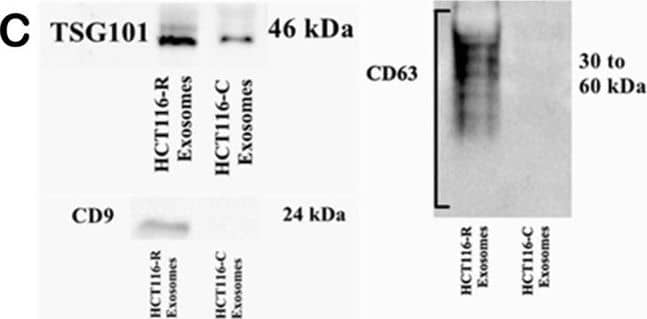 Western Blot: TSG101 Antibody (4A10) [NB200-112] - Characterization of exosomes. (A) Representative TEM images of exosomes at 22000x magnification (Left) HCT116-R exosomes & (Right) HCT116-P exosomes. (B) Enlarged planar view of a cup-shaped structure for single exosome in our samples at 87000x magnification. (C) Western blot analysis of exosomes revealed differential expression of TSG101, CD9, & CD63 between HCT116-R exosomes & HCT116-P exosomes. (D) Average size distribution & zeta potential of exosomes measured in Zetasizer. Image collected & cropped by CiteAb from the following publication (//pubmed.ncbi.nlm.nih.gov/31712601), licensed under a CC-BY license. Not internally tested by Novus Biologicals.