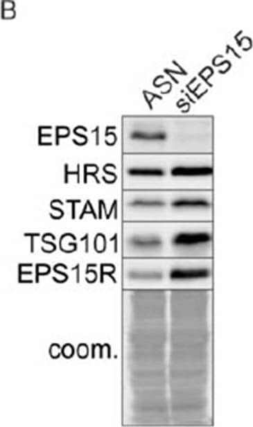 Western Blot: TSG101 Antibody (4A10) [NB200-112] - EPS15 depletion affects late endosomal maturation.(A) Co-depletion of SPOPL an EPS15 has an additive effect on influenza A virus infection. (B) EPS15 depletion stabilizes ESCRT components HRS, STAM & TSG101. (C) EPS15 depletion affects LDL uptake in cells resulting in an accumulation of LDL in enlarged vacuoles (upper panel). Late endosomes, visualized by life-cell microscopy of GFP-RAB7, are enlarged in cells depleted of EPS15 (lower panel).DOI://dx.doi.org/10.7554/eLife.13841.016 Image collected & cropped by CiteAb from the following publication (//elifesciences.org/articles/13841), licensed under a CC-BY license. Not internally tested by Novus Biologicals.