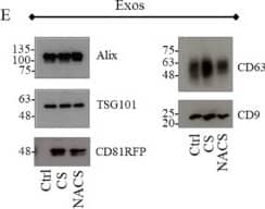 Western Blot TSG101 Antibody (4A10)