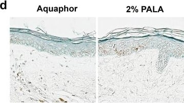 Immunohistochemistry beta-Defensin 3 Antibody - BSA Free