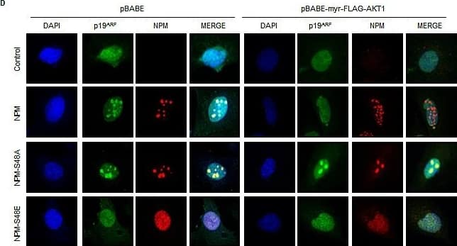 Immunocytochemistry/ Immunofluorescence: p19ARF/CDKN2A Antibody (5-C3-1) - BSA Free [NB200-174] - Phosphorylation of NPM-Ser48 regulates the localization of NPM & p19A(A) Npm−/−, p53−/−double null MEF were infected with pBabe retrovirus expressing FLAG-tagged-myr-AKT1 in combination with NPM-WT or NPM-S48A as indicated. Cells were fixed & stained with DAPI & anti-NPM (left) or anti-phospho-S48-NPM (pS48-NPM). (B) NPM immunoprecipitates & whole cell lysates from Npm−/−;p53−/− MEFs expressing human NPM or NPM-S48A were probed with the indicated antibodies.(C) Graph, quantification of p19ARF staining intensity in confocal images using ImageJ. (D) Npm−/−, p53−/−double null MEF were infected with pBABE retrovirus expressing FLAG-tagged-myr-AKT1 in combination with NPM-WT, NPM-S48A or S48E as indicated. Cells were fixed & stained with DAPI, anti-NPM & anti p19ARF. Image collected & cropped by CiteAb from the following publication (//pubmed.ncbi.nlm.nih.gov/25071014), licensed under a CC-BY license. Not internally tested by Novus Biologicals.