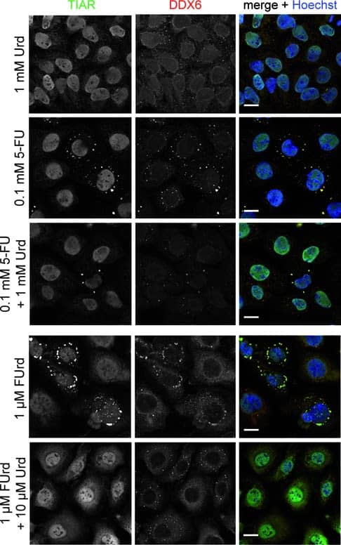 Immunocytochemistry/ Immunofluorescence: DDX6 Antibody [NB200-192] - 5-FU-induced SG assembly is rescued by interfering with RNA incorporation. HeLa cells were treated with 1 mM Urd, 0.1 mM 5-FU or both, as well as with 1 μM FUrd or a combination of 1 μM FUrd & 10 μM Urd. Localization of SG marker protein TIAR (green) & SG/P-body marker protein DDX6 (red) was investigated. Nuclei were stained with Hoechst. Scale bars represent 20 μm. Image collected & cropped by CiteAb from the following publication (//pubmed.ncbi.nlm.nih.gov/24728989), licensed under a CC-BY license. Not internally tested by Novus Biologicals.