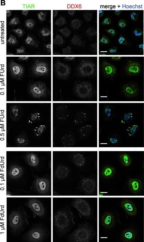 Immunocytochemistry/ Immunofluorescence: DDX6 Antibody [NB200-192] - 5-FU-induced SG assembly depends on RNA incorporation. (A) Schematic representation of the cellular 5-FU metabolism leading to incorporation of the different metabolites into RNA or DNA. (B) HeLa cells were treated with two concentrations of the 5-FU metabolites FUrd or FdUrd for 72 h. SG marker protein TIAR (green) & SG/P-body marker protein DDX6 (red) were visualized. Nuclei were stained with Hoechst. Scale bars represent 20 μm. Image collected & cropped by CiteAb from the following publication (//pubmed.ncbi.nlm.nih.gov/24728989), licensed under a CC-BY license. Not internally tested by Novus Biologicals.