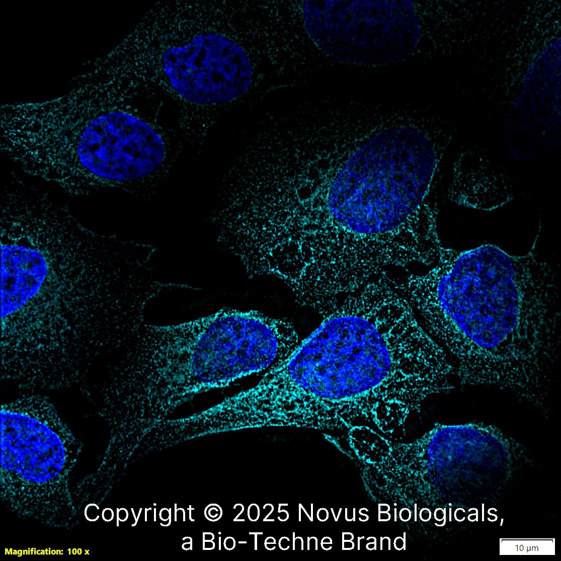 NQO-1 (A180) was detected in immersion fixed U-2 OS human osteosarcoma cell line using Mouse anti-NQO-1 (A180) Protein G Purified Monoclonal Antibody conjugated to DyLight 650 (Catalog # NB200-209C) (light blue) at 10 µg/mL overnight at 4C. Cells were counterstained with DAPI (blue). Cells were imaged using a 100X objective and digitally deconvolved.  