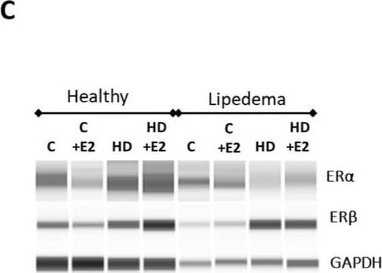 Expression of estrogen receptors in ASCs. (A). qRT-PCR shows a significant increase in ER gene expression in HD-treated healthy and lipedema ASCs (n = 3). (B). Quantification of Western Blot gels shows increased ER protein expression in HD-treated healthy and lipedema ASCs (n = 3). (C). Capillary Western blot (Jess) assay showing ER alpha , ER beta , and GADPH protein expression in an assembled gel-like image view. Values are means +/- SEM. * p < 0.05; ** p < 0.01. Image collected and cropped by CiteAb from the following open publication (//www.mdpi.com/2227-9059/12/5/1042), licensed under a CC-BY license. Not internally tested by Novus Biologicals.
