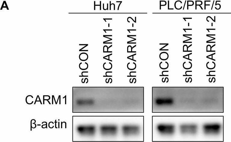 CARM1 promotes the proliferation of HCC cells.A Western blotting analysis showed the knockdown efficacy of CARM1 in Huh7 and PLC/PRF/5 cells infected with lentiviral particles expressing shRNAs targeting CARM1. B Proliferation of control and CARM1-knockdown Huh7 cells was detected by CCK-8 assays on the indicated days. C Colony formation assays were performed to detect the proliferation of control and CARM1-knockdown HCC cells. The data are presented in a bar chart. D Control or CARM1-knockdown Huh7 cells were subcutaneously injected into nude mice for observation of tumor growth. E The tumor volume was measured every three days and is presented as a line graph. F The tumor weights of the xenografts from the different groups were calculated. G Immunohistochemical analysis of mouse subcutaneous tumors was performed with anti-CARM1 and anti-Ki-67 antibodies. (n = 3; *p < 0.05, **p < 0.01, and ***p < 0.001). Image collected and cropped by CiteAb from the following open publication (//pubmed.ncbi.nlm.nih.gov/40016178), licensed under a CC-BY license. Not internally tested by Novus Biologicals.