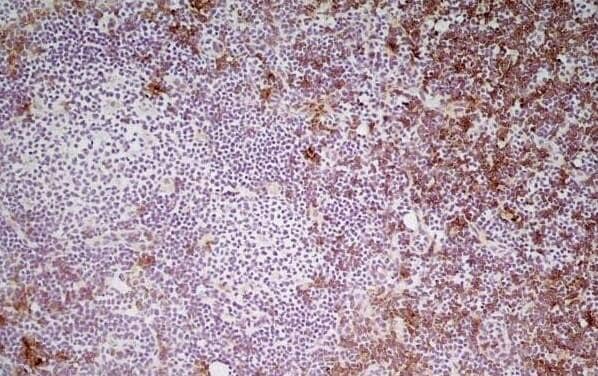 Immunoperoxidase staining of Mouse lymph node cryosection using CD8 Antibody (YTS105.18) - BSA Free followed by horseradish peroxidase conjugated Goat anti Rat IgG antibody  for detection. Medium power.