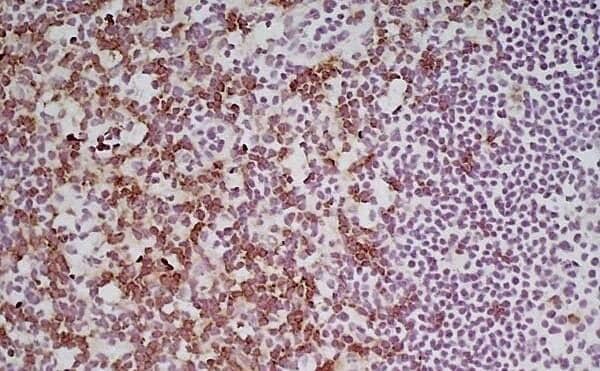 Immunoperoxidase staining of Mouse lymph node cryosection using CD8 Antibody (YTS105.18) - BSA Free followed by horseradish peroxidase conjugated Goat anti Rat IgG antibody  for detection. High power.