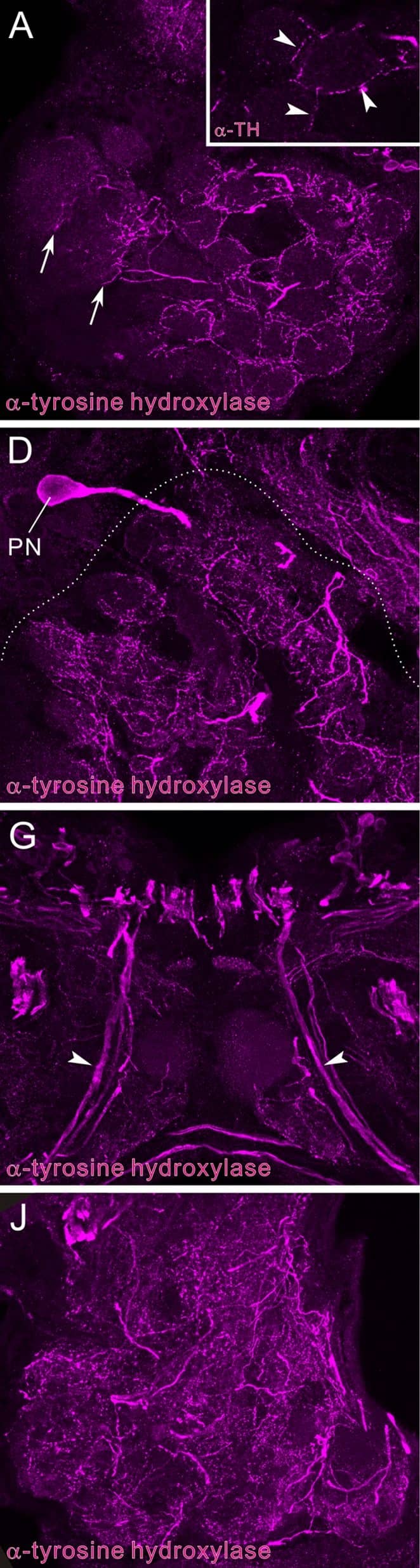 Immunocytochemistry/ Immunofluorescence: Tyrosine Hydroxylase Antibody [NB300-109] - Tyrosine hydroxylase immunoreactivity in the deutocerebrum & medial antennal lobe tract.Tyrosine hydroxylase (TH) immunoreactivity is shown in magenta (A, D, G, J) & synapsin immunoreactivity in green (B, E, H, K). Corresponding merged images (C, F, I, L). A-C: Frontal sections through the antennal lobe (AL). Insets indicate single optical slice (< 2 μm thickness) of the three glomeruli, which are marked by asterisks in main panel B. TH-positive fibers innervate antennal lobe glomeruli, predominantly the peripheral areas (see arrowheads in inset of A). In the macroglomerular complex (MGC), TH-positive fibers innervate exclusively the medial side (arrows in A). D-F: Horizontal sections through the antennal lobe. A single TH-positive multiglomerular projection neuron (PN) is labeled, which projects its axon toward the medial antennal lobe tract (MALT, see also panel G). G-I: Frontal sections through the medial antennal lobe tract containing several TH-positive axons (arrowheads). J-L: Frontal sections through the lobus glomerulatus (LG) & the antennal mechanosensory & motor center (AMMC). TH-immunoreactive fibers are widely distributed in the AMMC. In the lobus glomerulatus, immunoreactive fibers predominantly innervate the ventral portion. D, dorsal; M, medial; ML, medial lobe; NO, noduli; P, posterior; PB, protocerebral bridge. Scale bars = 50 μm in inset of C; 100 μm in C, F, I, L. Image collected & cropped by CiteAb from the following publication (//dx.plos.org/10.1371/journal.pone.0160531), licensed under a CC-BY license. Not internally tested by Novus Biologicals.