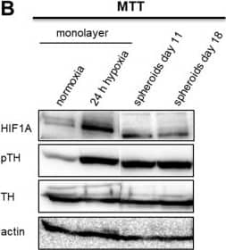 Western Blot: Tyrosine Hydroxylase Antibody [NB300-109] - Impact of extrinsic & intrinsic hypoxia on catecholamine biosynthesis. (A) Section of biosynthetic pathways of catecholamines. Squares highlighted the underlying enzymes (TH: tyrosine hydroxylase; DDC: DOPA decarboxylase; DBH: dopamine  beta -hydroxylase; PNMT: phenylethanolamine N-methyltransferase). (B) Effect of extrinsic & intrinsic hypoxia on the protein expression & phosphorylation of TH at Ser40 in MTT cells. (C) Immunohistochemical staining showed an increased expression of TH (red) in the necrotic & hypoxic core of the spheroid (DAPI, blue). Scale bar: 200 µm. Catecholamine content of (D) MPC & (E) MTT cell spheroids in comparison to monolayer cultivation under normoxic or hypoxic conditions. Three independent experiments (n = 3–6). Mean ± SEM. ANOVA & Bonferroni post hoc test comparison vs. normoxia, ** p < 0.01, or vs. spheroid day 11, # p < 0.05 or, ## p < 0.01. Image collected & cropped by CiteAb from the following publication (//pubmed.ncbi.nlm.nih.gov/31035382), licensed under a CC-BY license. Not internally tested by Novus Biologicals.
