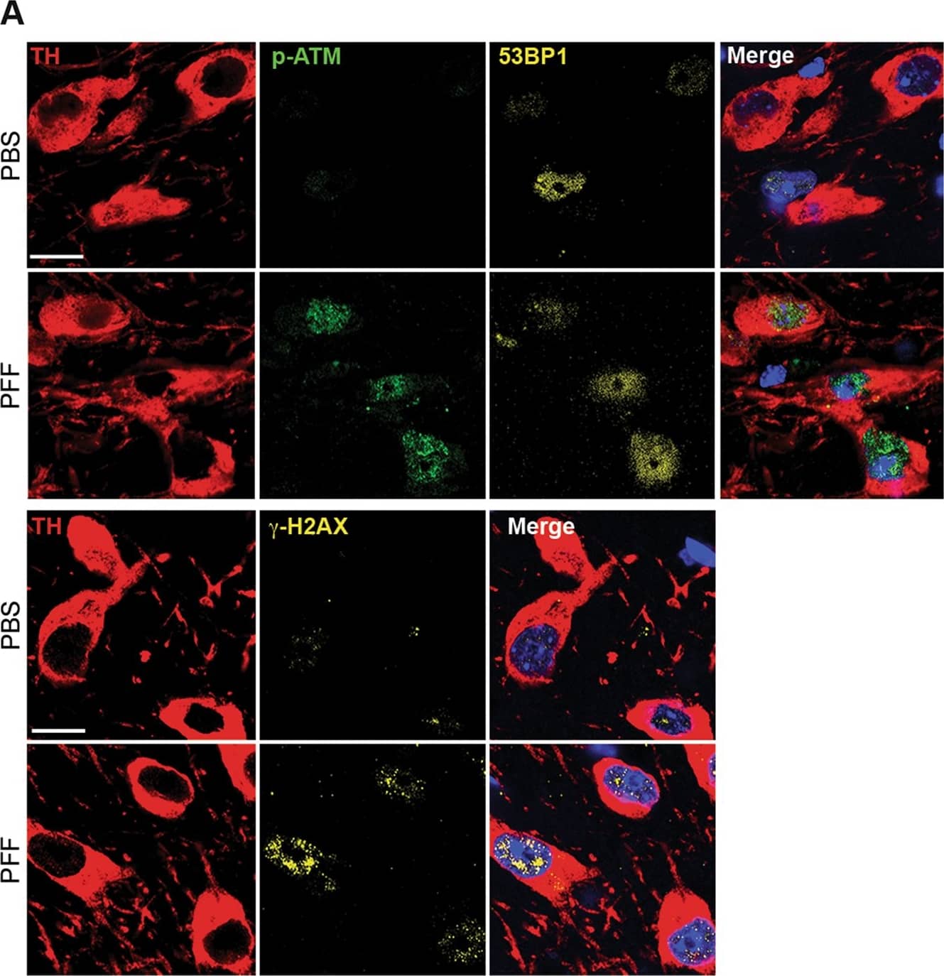 Immunocytochemistry/ Immunofluorescence: Tyrosine Hydroxylase Antibody [NB300-110] - Activation of the DDR in mice injected with  alpha -syn PFF in the striatum.Augmented levels 53BP1 &  gamma H2AX foci, & ATM phosphorylation in dopamine neurons of the substantia nigra. Scale bar: 50 μm. (**p < 0.01; ***p < 0.001; Student’s t test). All bar graphs show mean + /− s.e.m Image collected & cropped by CiteAb from the following publication (//pubmed.ncbi.nlm.nih.gov/30050065), licensed under a CC-BY license. Not internally tested by Novus Biologicals.