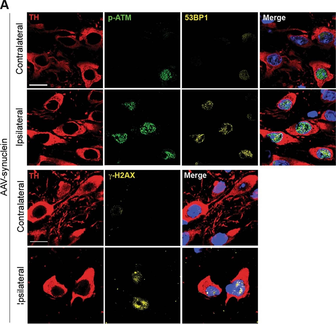 Immunocytochemistry/ Immunofluorescence: Tyrosine Hydroxylase Antibody [NB300-110] - Activation of the DDR in mice transduced with AAV2/6 h-syn.a h-syn expression increases 53BP1 &  gamma H2AX foci, & ATM phosphorylation in nigral dopaminergic neurons. b The DDR is not activated by viral delivery of GFP. Scale bar: 50 μm. (**p < 0.01; ***p < 0.001; Student’s t test). All bar graphs show mean + /− s.e.m Image collected & cropped by CiteAb from the following publication (//pubmed.ncbi.nlm.nih.gov/30050065), licensed under a CC-BY license. Not internally tested by Novus Biologicals.