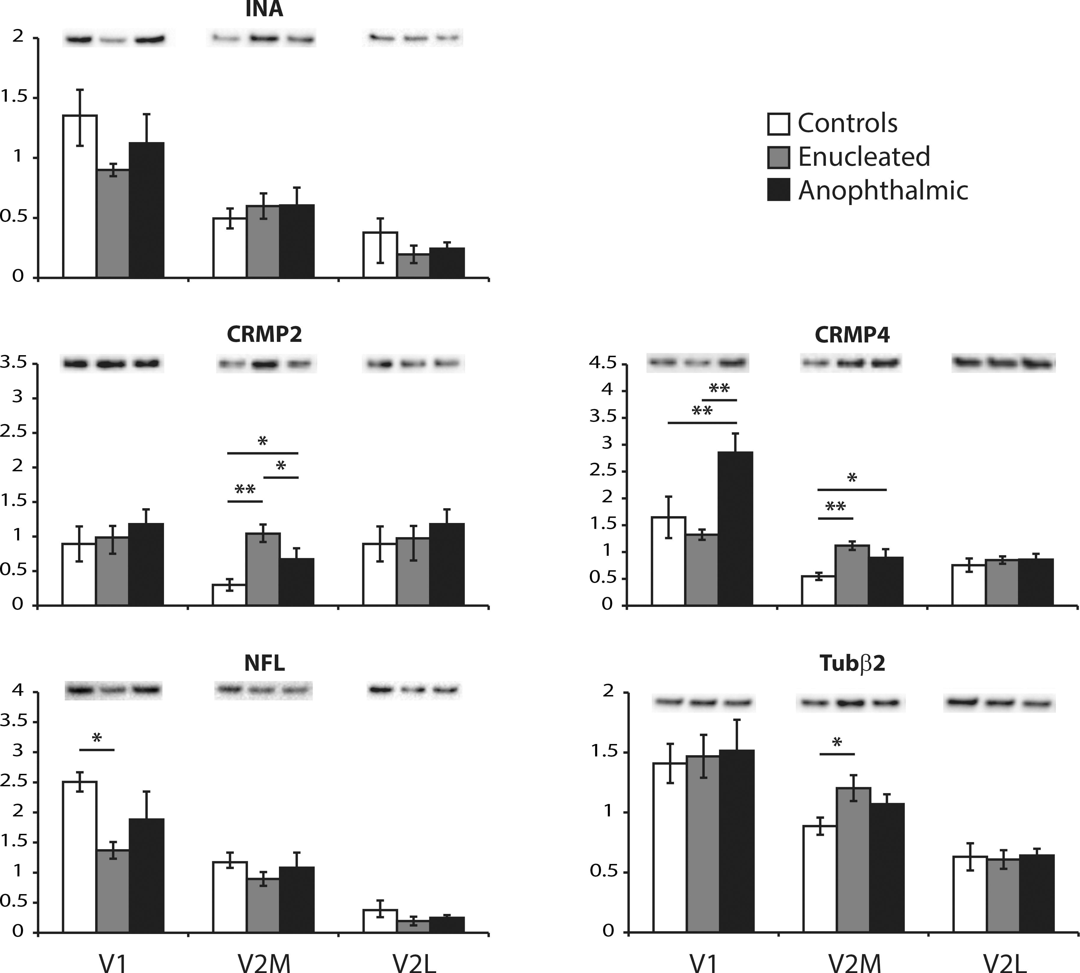 Proteins involved in morphogenesis.The expression of a-internexin (INA), collapsing response mediator protein 2 (CRMP2) and 4 (CRMP4), neurofilament-low (NFL) and tubuline-b2 (Tub beta 2) were analyzed by Western blotting. White bars are controls, grey bars are enucleated and black bars are anophthalmic mice. Results from V1 (left), V2M (middle) and V2L (right) are shown for each protein. * P < 0.05 and ** P < 0.01.