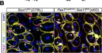 Immunocytochemistry/ Immunofluorescence: Laminin Antibody [Alexa Fluor® 647] [NB300-144AF647] - SOX17 regulates adult muscle regeneration after injury in Pax7CreERT2/+;Sox17fl/fl mutant mice.(A) Schematic outline of experimental procedure for tamoxifen (TMX) injection (i.p., intraperitoneal). CTX, cardiotoxin injection; d, days. (B) Representative images of cryosections from regenerating adult TA muscles d7 after injury, showing immunofluorescence for PAX7+ (quiescent, arrows) & PH3+PAX7+ (proliferating, arrowheads) cells. Scale bar, 25 μm. (C–D) Quantification of satellite cells as illustrated in (B). (E) Schematic outline of experimental procedure for TMX diet. CTX, cardiotoxin injection; d, days. (F) Representative images of cryosections from regenerating adult TA muscles d28 after injury, showing immunofluorescence for PAX7+ (quiescent, arrows) cells. Scale bar, 25 µm. (G) Quantification of satellite cells as illustrated in (F). (H–I) Quantification of cross-sectional area in µm2 (H) & myofiber number per mm2 (I). (J–K) Quantification of fat infiltration (Oil red O) (J) & fibrosis (Sirius red) (K) indicated as proportion of stained section (average of five sections per muscle). (L) Representative images of histological characterization of adult TA muscles 28 days after injury w/ Hematoxylin & eosin (cell infiltration; upper panel), Oil red O (fat infiltration; middle panel), & Sirius red (fibrosis; bottom panel) staining. Scale bars, 100 µm. CTRL, Sox17fl/fl; cKO, Pax7CreERT2/+;Sox17fl/fl. n ≥ 3 mice (each quantified at least in triplicate) for all experiments. Data expressed as mean ± s.e.m., statistically analyzed w/ Student’s unpaired t-test (C,D,G) & Mann-Whitney ranking test (H–K): n.s., not significant; *, p<0.05; **, p<0.01; ***, p<0.001, compared to CTRL. Image collected & cropped by CiteAb from following publication (//pubmed.ncbi.nlm.nih.gov/29882512), licensed under a CC-BY license. Not internally tested by Novus Biologicals.