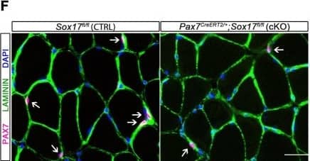 Immunocytochemistry/ Immunofluorescence: Laminin Antibody [Alexa Fluor® 647] [NB300-144AF647] - SOX17 is necessary to maintain satellite cell quiescence in adult muscles.(A,F) Representative Soleus cryosection images showing immunofluorescence for satellite cells (PAX7+, arrows) in Pax3Cre/+;Sox17GFP/fl & Pax7CreERT2/+;Sox17fl/fl mice, with appropriate controls. Scale bars, 25 μm. Fibers are identified by LAMININ & nuclei are counterstained with DAPI. (B,G) Quantification of satellite cell number during postnatal growth (P14) & in adult. (C) Quantification of the ratio PAX7/MYOD+ satellite cells in P14 Soleus cryosections. (D) RT-qPCR analysis on adult TA muscles for Pax7 & SoxF genes in fresh FACS-isolated satellite cells from control & Sox17-knockout mice. (A–D) CTRL, Sox17GFP/fl; KO, Pax3Cre/+;Sox17GFP/fl. (E) Schematic outline of the experimental procedure for tamoxifen (TMX) injection (i.p., intraperitoneal) in Sox17fl/fl (CTRL) & Pax7CreERT2/+;Sox17fl/fl (cKO) mice. d, days. (E–G) CTRL, Sox17fl/fl; cKO, Pax7CreERT2/+;Sox17fl/fl. Quantification was performed in whole cross-sections. n ≥ 4 mice (each quantified in triplicate) for all experiments. Data expressed as mean ± s.e.m., statistically analyzed with Student’s unpaired t-test: *, p<0.05; **, p<0.01, compared to CTRL.Satellite cells characterization of control & Sox17-knockout mice.(A) Immunofluorescence of satellite cells (MCAD; M-cadherin) in adult Soleus cryosections from control & Sox17 mutant mice. Scale bar, 25 μm. (B) Quantification of satellite cell number illustrated in (A). CTRL, Sox17GFP/fl; KO, Pax3Cre/+;Sox17GFP/fl. n ≥ 4 mice (each quantified in triplicate) for all experiments. Data expressed as mean ± s.e.m., statistically analyzed with Student’s unpaired t-test: *, p<0.05, compared to CTRL. Image collected & cropped by CiteAb from the following publication (//pubmed.ncbi.nlm.nih.gov/29882512), licensed under a CC-BY license. Not internally tested by Novus Biologicals.