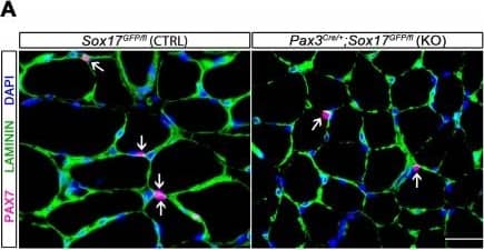 Immunocytochemistry/ Immunofluorescence: Laminin Antibody [Alexa Fluor® 647] [NB300-144AF647] - SOX17 is necessary to maintain satellite cell quiescence in adult muscles.(A,F) Representative Soleus cryosection images showing immunofluorescence for satellite cells (PAX7+, arrows) in Pax3Cre/+;Sox17GFP/fl & Pax7CreERT2/+;Sox17fl/fl mice, with appropriate controls. Scale bars, 25 μm. Fibers are identified by LAMININ & nuclei are counterstained with DAPI. (B,G) Quantification of satellite cell number during postnatal growth (P14) & in adult. (C) Quantification of the ratio PAX7/MYOD+ satellite cells in P14 Soleus cryosections. (D) RT-qPCR analysis on adult TA muscles for Pax7 & SoxF genes in fresh FACS-isolated satellite cells from control & Sox17-knockout mice. (A–D) CTRL, Sox17GFP/fl; KO, Pax3Cre/+;Sox17GFP/fl. (E) Schematic outline of the experimental procedure for tamoxifen (TMX) injection (i.p., intraperitoneal) in Sox17fl/fl (CTRL) & Pax7CreERT2/+;Sox17fl/fl (cKO) mice. d, days. (E–G) CTRL, Sox17fl/fl; cKO, Pax7CreERT2/+;Sox17fl/fl. Quantification was performed in whole cross-sections. n ≥ 4 mice (each quantified in triplicate) for all experiments. Data expressed as mean ± s.e.m., statistically analyzed with Student’s unpaired t-test: *, p<0.05; **, p<0.01, compared to CTRL.Satellite cells characterization of control & Sox17-knockout mice.(A) Immunofluorescence of satellite cells (MCAD; M-cadherin) in adult Soleus cryosections from control & Sox17 mutant mice. Scale bar, 25 μm. (B) Quantification of satellite cell number illustrated in (A). CTRL, Sox17GFP/fl; KO, Pax3Cre/+;Sox17GFP/fl. n ≥ 4 mice (each quantified in triplicate) for all experiments. Data expressed as mean ± s.e.m., statistically analyzed with Student’s unpaired t-test: *, p<0.05, compared to CTRL. Image collected & cropped by CiteAb from the following publication (//pubmed.ncbi.nlm.nih.gov/29882512), licensed under a CC-BY license. Not internally tested by Novus Biologicals.