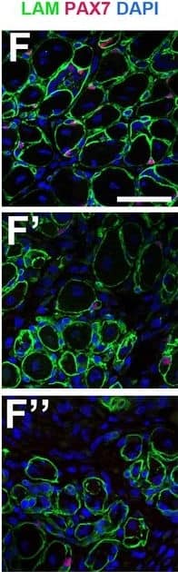 Immunocytochemistry/ Immunofluorescence: Laminin Antibody [Alexa Fluor® 647] [NB300-144AF647] - MuSC-specific Cdkn1c ablation hinders muscle regeneration.(A) Time-course of tamoxifen administration, intramuscular injury of TA muscle (CTX arrow), & muscle harvest (D7 arrow). (B–G) Cryosections of TA muscle were stained for histological & satellite cell population characterization 7 days after CTX injection. Analyzed animals at (B-G) were wild-type littermates (Wt; Pax7+; Cdkn1c+; B–G), Cre control (Pax7CreERT2; B’–G’), & Cdkn1c cKO (Pax7CreERT2; Cdkn1cFlox; B’’–G’’). (B) HE staining for histologic characterization of the muscles. (C) Oil Red O staining for evaluation of fat infiltration of the muscles. (D–E) embryonic myosin (eMYHC, red)/LAMININ (LAM, green) immunofluorescence to mark newly formed myofibers post-regeneration. (F–G) PAX7 (red)/LAMININ (LAM, green) immunofluorescence to mark PAX7+ satellite cells. Nuclei in (D-G) were counter-stained with DAPI (blue). Scale bars, 50 μm. (H) Quantification of (F-G). Data show mean +SD, n ≥ 5 animals. Asterisks indicate significance; **p≤0.01.In vivo MuSC-specific Cdkn1c ablation. Image collected & cropped by CiteAb from the following publication (//pubmed.ncbi.nlm.nih.gov/30284969), licensed under a CC-BY license. Not internally tested by Novus Biologicals.