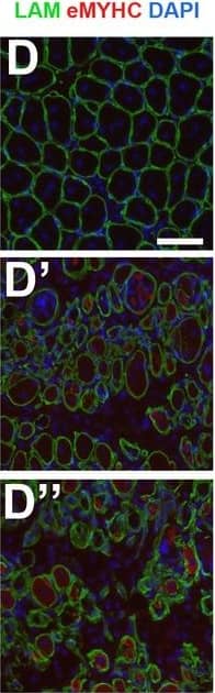 Immunocytochemistry/ Immunofluorescence: Laminin Antibody [Alexa Fluor® 647] [NB300-144AF647] - MuSC-specific Cdkn1c ablation hinders muscle regeneration.(A) Time-course of tamoxifen administration, intramuscular injury of TA muscle (CTX arrow), & muscle harvest (D7 arrow). (B–G) Cryosections of TA muscle were stained for histological & satellite cell population characterization 7 days after CTX injection. Analyzed animals at (B-G) were wild-type littermates (Wt; Pax7+; Cdkn1c+; B–G), Cre control (Pax7CreERT2; B’–G’), & Cdkn1c cKO (Pax7CreERT2; Cdkn1cFlox; B’’–G’’). (B) HE staining for histologic characterization of the muscles. (C) Oil Red O staining for evaluation of fat infiltration of the muscles. (D–E) embryonic myosin (eMYHC, red)/LAMININ (LAM, green) immunofluorescence to mark newly formed myofibers post-regeneration. (F–G) PAX7 (red)/LAMININ (LAM, green) immunofluorescence to mark PAX7+ satellite cells. Nuclei in (D-G) were counter-stained with DAPI (blue). Scale bars, 50 μm. (H) Quantification of (F-G). Data show mean +SD, n ≥ 5 animals. Asterisks indicate significance; **p≤0.01.In vivo MuSC-specific Cdkn1c ablation. Image collected & cropped by CiteAb from the following publication (//pubmed.ncbi.nlm.nih.gov/30284969), licensed under a CC-BY license. Not internally tested by Novus Biologicals.