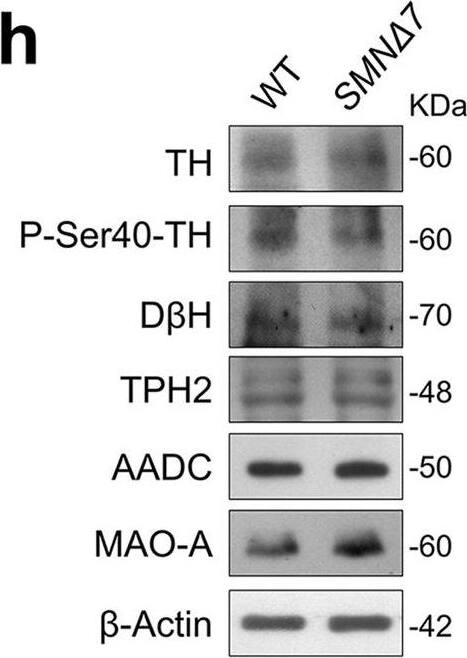 Expression levels of monoamine-regulating enzymes in the brain of SMN delta 7 mice.a, h, o Representative autoradiograms of brain lysates immunoblots of SMN delta 7 and wild-type (WT) mice at a post-natal day 3, h day 6, and o day 11. b–g Protein levels quantification of b Tyrosine hydroxylase (TH), c phospho-Tyrosine hydroxylase at Ser-40 (P-Ser40-TH), d Dopamine  beta  hydroxylase (D beta H), e Tryptophan hydroxylase 2 (TPH2), f Aromatic amino acid decarboxylase (AADC) and g Monoamine Oxidase A (MAO-A) in SMN delta 7 (n = 4) and WT (n = 5) mice (except for TPH2: n = 4 mice/genotype) at post-natal day 3. i–n Protein levels quantification of i TH (n = 4 WT, n = 5 SMN delta 7), j P-Ser40-TH (n = 4 WT, n = 5 SMN delta 7), k D beta H (n = 4 WT, n = 4 SMN delta 7), l TPH2 (n = 4 WT, n = 3 SMN delta 7), m AADC (n = 4 WT, n = 5 SMN delta 7) and n MAO-A (n = 4 WT, n = 5 SMN delta 7) at post-natal day 6. p–u Protein levels quantification of p TH (n = 13 WT, n = 14 SMN delta 7), q P-Ser40-TH (n = 4 WT, n = 5 SMN delta 7), r D beta H (n = 4 WT, n = 5 SMN delta 7), s TPH2 (n = 4 WT, n = 5 SMN delta 7), t AADC (n = 13 WT, n = 14 SMN delta 7) and u MAO-A (n = 8 WT, n = 10 SMN delta 7) at post-natal day 11. Data are normalized to  beta -Actin levels and shown as box and whisker plots representing the median with interquartile range (IQR). Dots represent individual mice values. *p < 0.05, **p < 0.01, compared with age-matched WT mice (unpaired t-test). Image collected and cropped by CiteAb from the following open publication (//pubmed.ncbi.nlm.nih.gov/37957344), licensed under a CC-BY license. Not internally tested by Novus Biologicals.