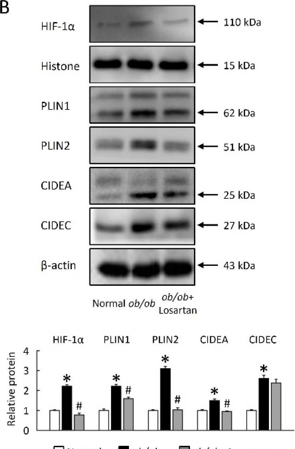 Losartan decreased HIF-1 alpha  and LD-associated proteins. (A) Representative HE, Oil Red O, HIF-1 alpha , PLIN1, PLIN2, CIDEA and CIDEC staining of liver from normal mice and losartan-treated ob/ob mice. Green pseudo-color represents visualization of lipofuscin’s autofluorescence at 450–490 nm. Red arrow highlights the positive staining. Scale bar: 100 μm. Quantification of (B) HIF-1 alpha , PLIN1, PLIN2, CIDEA, and CIDEC protein levels by Western blot of liver after losartan treatment. Below graphs indicate quantification relative to Histone or  beta -actin. (C) Quantification of ATGL, HSL, LPL, and ACO by qRT-PCR. qRT-PCR indicates quantification relative to GAPDH. For each animal group, n = 5. All values represent the mean +/- SEM. Data were analyzed by Student’s t test. * p ≤ 0.05; normal vs. ob/ob. # p ≤ 0.05; ob/ob vs. ob/ob + Losartan. HIF-1 alpha , hypoxia-inducible factor-1 alpha ; LDs, lipid droplets; HE, hematoxylin and eosin; PLIN, perilipin; CIDE, cell-death-inducing DNA-fragmentation-factor (DFF45)-like effector; ATGL, adipose triglyceride lipase; HSL, hormone-sensitive lipase; LPL, lipoprotein lipase; ACO, acyl-CoA oxidase. Image collected and cropped by CiteAb from the following open publication (//pubmed.ncbi.nlm.nih.gov/34360607), licensed under a CC-BY license. Not internally tested by Novus Biologicals.