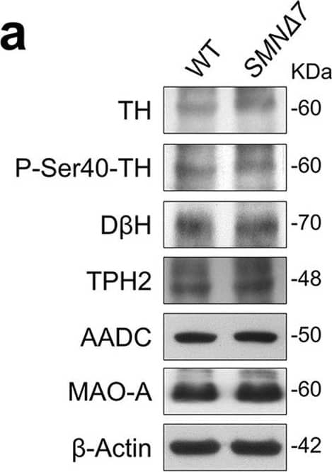 Expression levels of monoamine-regulating enzymes in the brain of SMN delta 7 mice.a, h, o Representative autoradiograms of brain lysates immunoblots of SMN delta 7 and wild-type (WT) mice at a post-natal day 3, h day 6, and o day 11. b–g Protein levels quantification of b Tyrosine hydroxylase (TH), c phospho-Tyrosine hydroxylase at Ser-40 (P-Ser40-TH), d Dopamine  beta  hydroxylase (D beta H), e Tryptophan hydroxylase 2 (TPH2), f Aromatic amino acid decarboxylase (AADC) and g Monoamine Oxidase A (MAO-A) in SMN delta 7 (n = 4) and WT (n = 5) mice (except for TPH2: n = 4 mice/genotype) at post-natal day 3. i–n Protein levels quantification of i TH (n = 4 WT, n = 5 SMN delta 7), j P-Ser40-TH (n = 4 WT, n = 5 SMN delta 7), k D beta H (n = 4 WT, n = 4 SMN delta 7), l TPH2 (n = 4 WT, n = 3 SMN delta 7), m AADC (n = 4 WT, n = 5 SMN delta 7) and n MAO-A (n = 4 WT, n = 5 SMN delta 7) at post-natal day 6. p–u Protein levels quantification of p TH (n = 13 WT, n = 14 SMN delta 7), q P-Ser40-TH (n = 4 WT, n = 5 SMN delta 7), r D beta H (n = 4 WT, n = 5 SMN delta 7), s TPH2 (n = 4 WT, n = 5 SMN delta 7), t AADC (n = 13 WT, n = 14 SMN delta 7) and u MAO-A (n = 8 WT, n = 10 SMN delta 7) at post-natal day 11. Data are normalized to  beta -Actin levels and shown as box and whisker plots representing the median with interquartile range (IQR). Dots represent individual mice values. *p < 0.05, **p < 0.01, compared with age-matched WT mice (unpaired t-test). Image collected and cropped by CiteAb from the following open publication (//pubmed.ncbi.nlm.nih.gov/37957344), licensed under a CC-BY license. Not internally tested by Novus Biologicals.