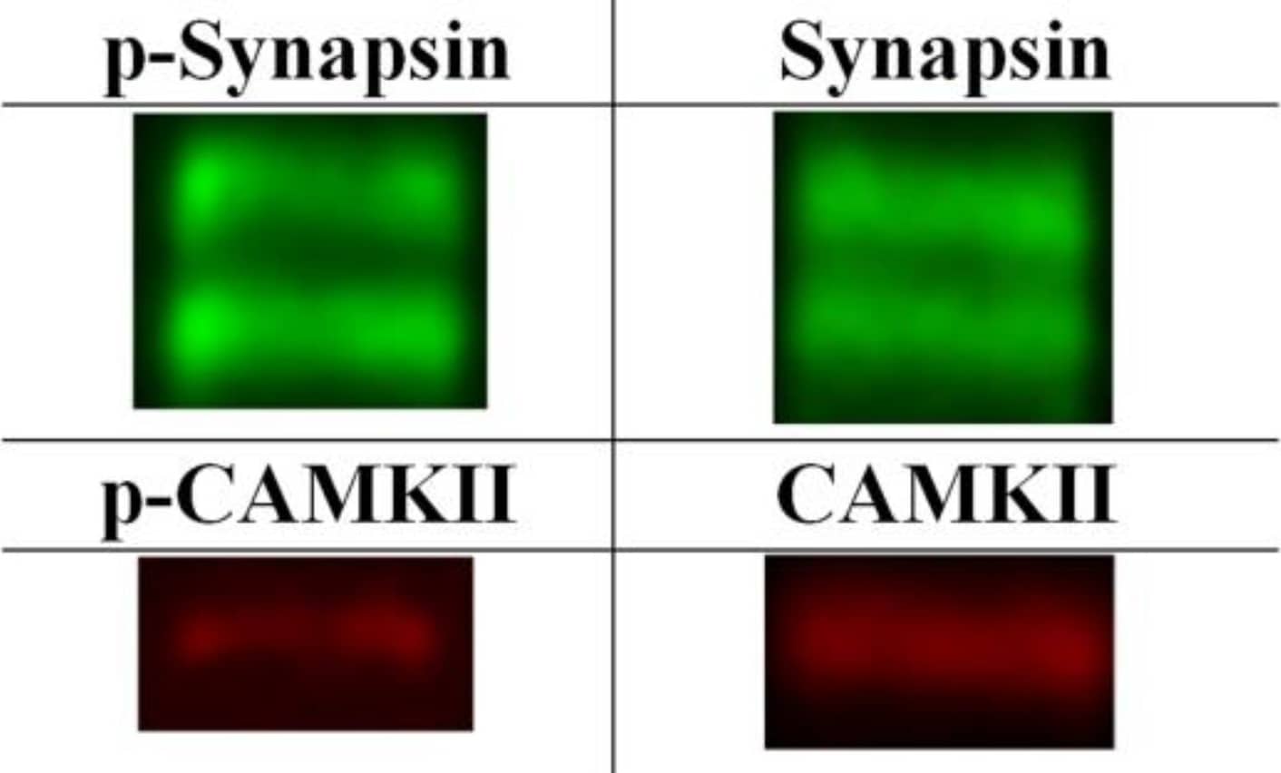 Western Blot: Synapsin I [p Ser603] Antibody [NB300-181] - Examples of Western blots of p-/synapsin 1 & p-/Ca2+-calmodulin-dependent kinase II. The figure depicts examples of the Western blots of the four synaptic plasticity markers investigated. The two bands seen in the p-synapsin & synapsin Western blots (70 & 74 kDa respectively) are consistent with splice variants as confirmed by manufacturer. P-CAMKII & CAMKII were detected around 50 kDa in accordance with previous findings. Image collected & cropped by CiteAb from the following publication (//pubmed.ncbi.nlm.nih.gov/29890692), licensed under a CC-BY license. Not internally tested by Novus Biologicals.