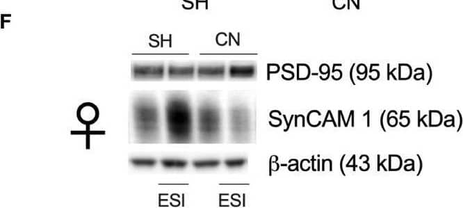 Effect of SH, CN and ESI protocol on synaptic structural markers expression in the crude membrane fraction of the mPFC of PND-75 male (top) and female (bottom) rats. Protein levels of PSD95 (A), SynCAM 1 (B) in male rats and PSD95 (C), SynCAM 1 (D) in female rats are expressed as percentages of SH-CTRL and represent the mean +/- S.E.M. of six rats per group (SynCAM: 1 outlier in CN-CTRL males). Representative immunoblots (bottom) are shown for each protein in the respective panels (E, F). *p<0.05 vs. SH-CTRL, $p<0.05, $$p<0.01, $$$p<0.001 vs CN+CTRL (Two-way ANOVA followed by Tukey’s multiple comparisons test). SH, Standard Housing; CN, Communal Nesting; CTRL, controls no ESI; ESI, Early Social Isolation. Image collected and cropped by CiteAb from the following open publication (//pubmed.ncbi.nlm.nih.gov/38835543), licensed under a CC-BY license. Not internally tested by Novus Biologicals.
