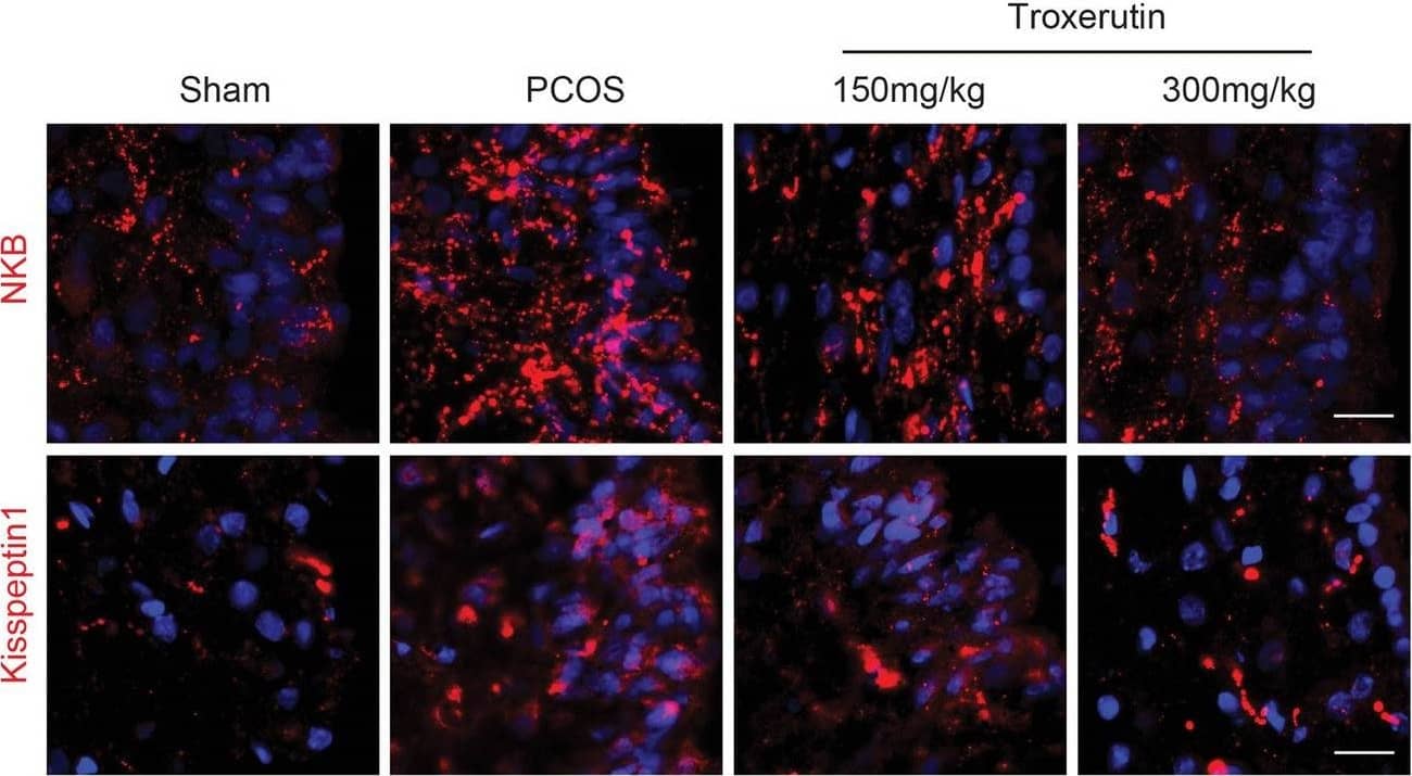 Immunocytochemistry/ Immunofluorescence: Neurokinin B Antibody - BSA Free [NB300-201] - Troxerutin reduced the expression of Kisspepetin1 & Neurokinin B in the ARC. a Immunofluorescence photomicrograph showing that the expression of Kisspeptin1 & NKB in the arcuate nucleus (ARC). Scale bars:20 μm. b A lower magnification image showing the whole ARC & median eminence. Rectangular frame a & b represent ARC & median eminence (ME) analyzed in Fig. 5a & Fig. 6a, respectively. Scale bars:200 μm. c Quantitative analysis of integral optical density (IOD) of Kisspeptin1 & NKB in the ARC. P values were determined by one-way ANOVA with Tukey’s multiple comparison test & data were presented as means±s.e.m. n = 4 per group. **P < 0.01, ***P < 0.001vs. sham group; #P < 0.05, ##P < 0.01 vs. PCOS group Image collected & cropped by CiteAb from the following publication (//pubmed.ncbi.nlm.nih.gov/32921318), licensed under a CC-BY license. Not internally tested by Novus Biologicals.